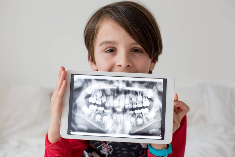 Boy HOlding Xray Photo of Teeth