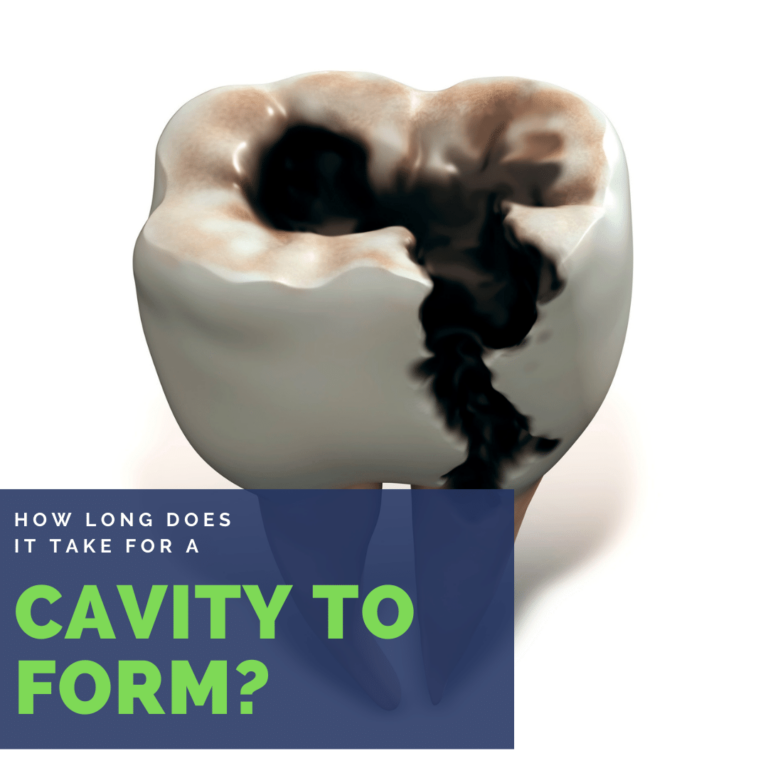 How long does it take for a cavity to form banner