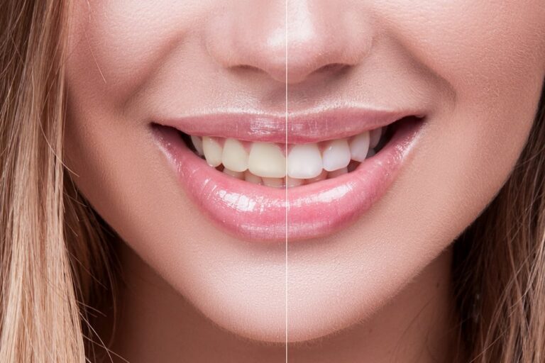 Young woman yellow and white teeth