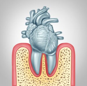 anatomical shaped heart in tooth socket