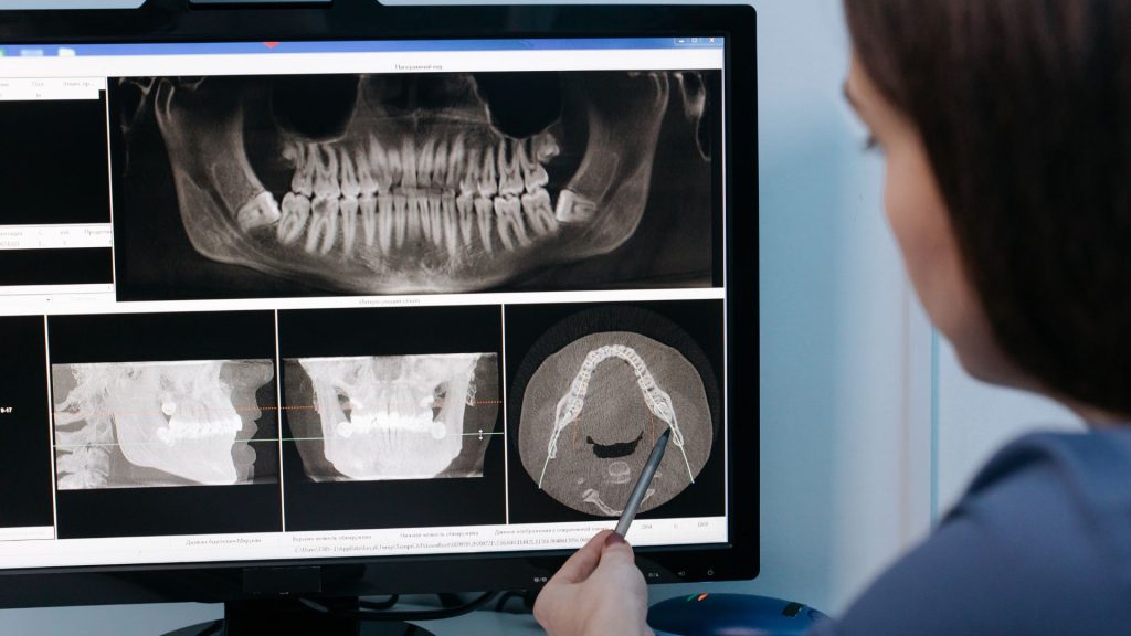 A person points at digital dental x-rays and CT scans displayed on a computer monitor, showing various views of teeth and jaw structure.