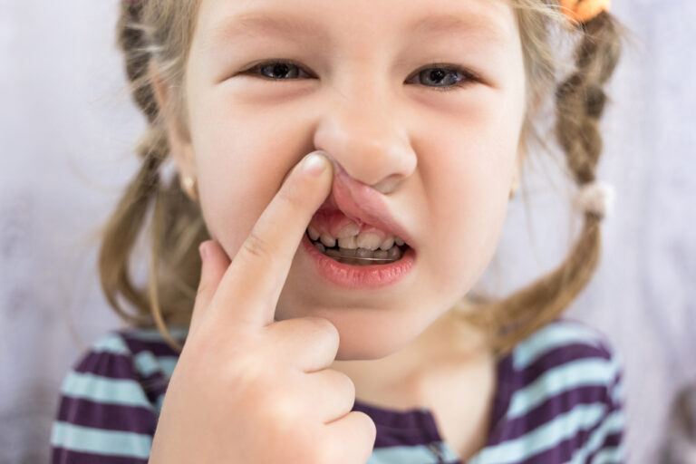 When Should My Childs Teeth Erupt