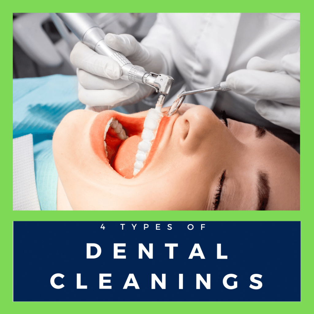 4 types of dental cleaning banner