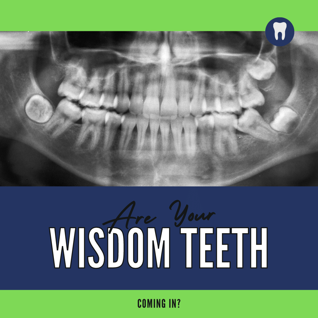 Are Your wisdom teeth banner