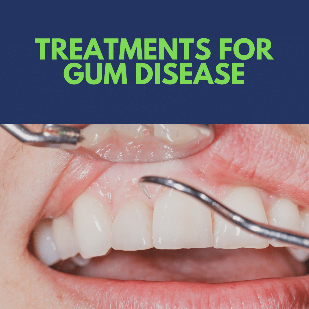 treatment for gum disease