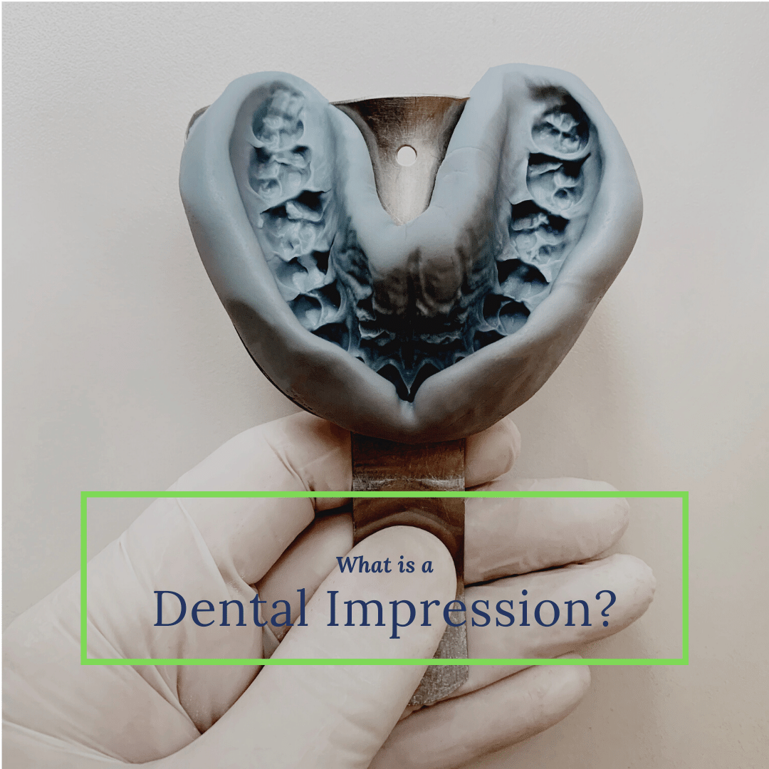 What is a Dental Impression banner