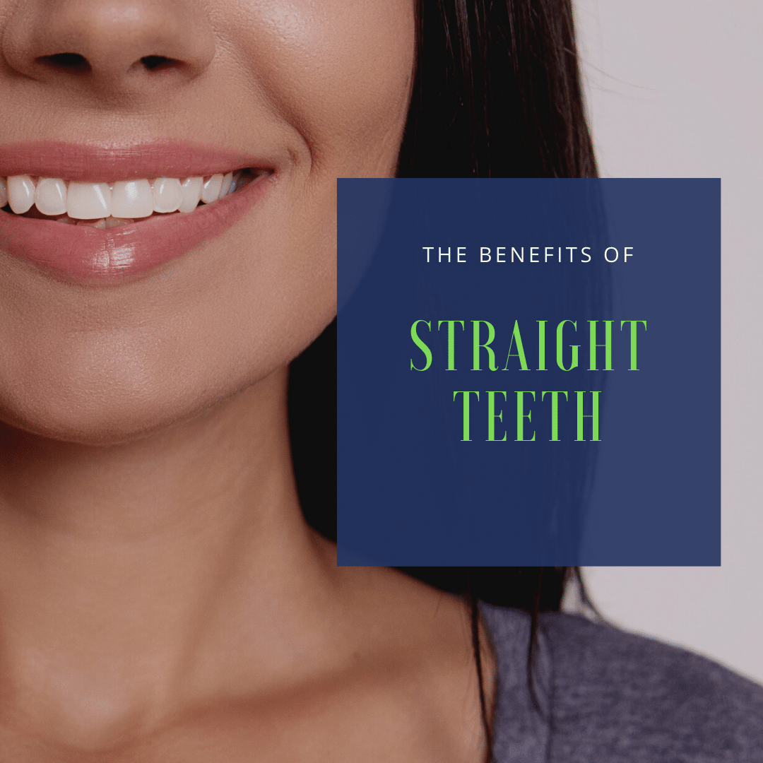 The Benefits of Straight Teeth2